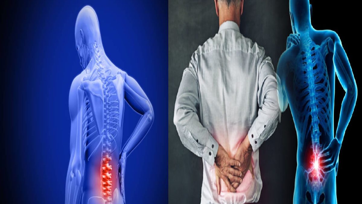 Lower Back Pain – Meaning, Symptoms, Causes, And More