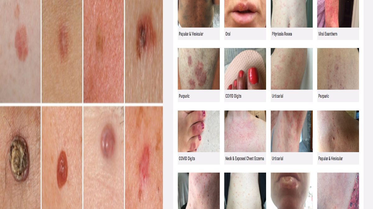 Skin Conditions – Explaining, Skin Diseases, Disorders, And More