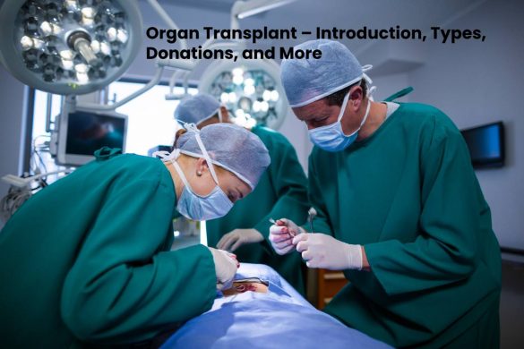 organ transplant (1)