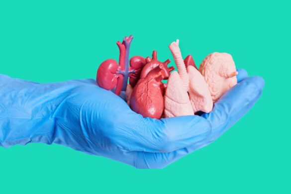Organ Transplant